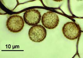 Attēlu rezultāti vaicājumam “Stemonitis fusca spores”