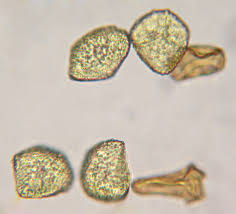 Attēlu rezultāti vaicājumam “Phaeoceros laevis subsp. carolinianus”