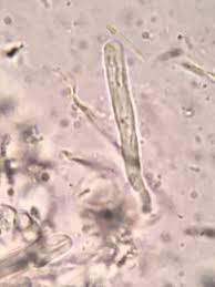 Attēlu rezultāti vaicājumam “Hyalorbilia inflatula”