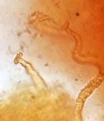 Attēlu rezultāti vaicājumam “Trichiaceae, Hemitrichiaceae, Arcyriaceae”