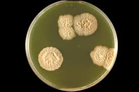 Attēlu rezultāti vaicājumam “Didymium minus spores”