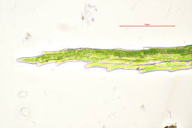 Attēlu rezultāti vaicājumam “Leptobryum pyriforme sporophyte”