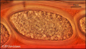 Attēlu rezultāti vaicājumam “Pertusaria leioplaca”
