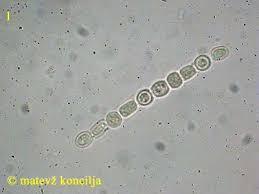 Attēlu rezultāti vaicājumam “Hypocrea rufa”