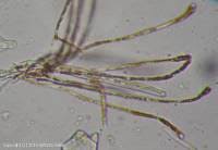 Attēlu rezultāti vaicājumam “Octospora humosa”