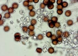 Attēlu rezultāti vaicājumam “Didymium bahiense”