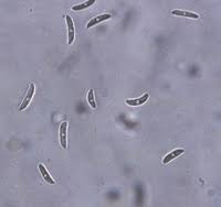 Attēlu rezultāti vaicājumam “Dianema nivale spores”