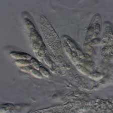 Attēlu rezultāti vaicājumam “Dermatocarpon luridum”