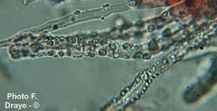 Attēlu rezultāti vaicājumam “Aleurodiscus amorphus”