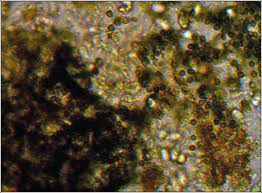 Attēlu rezultāti vaicājumam “Lichenoconium xanthoriae”