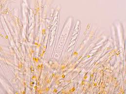 Attēlu rezultāti vaicājumam “Mitrula paludosa”