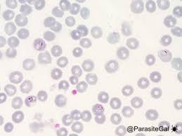 Attēlu rezultāti vaicājumam “Reticularia lobata plasmodium”