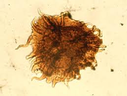 Attēlu rezultāti vaicājumam “Diachea muscorum spores”