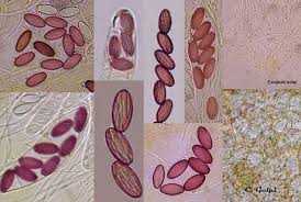 Attēlu rezultāti vaicājumam “Ascobolus furfuraceus”