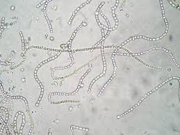 Attēlu rezultāti vaicājumam “Nostoc commune”
