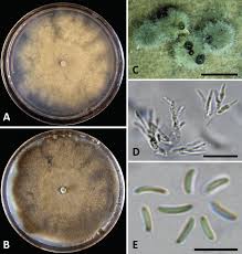 Attēlu rezultāti vaicājumam “Diachea dictyospora (syn. Craterium dictyosporum) spores”