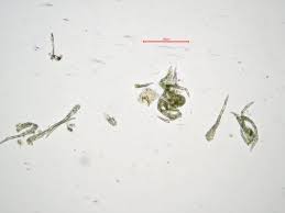 Attēlu rezultāti vaicājumam “Hypnum cupressiforme var. subjulacum”