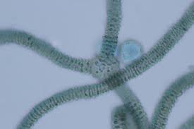 Attēlu rezultāti vaicājumam “Arcyria affinis capillitium”