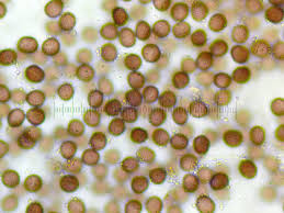 Attēlu rezultāti vaicājumam “Physarum cinereum macro”