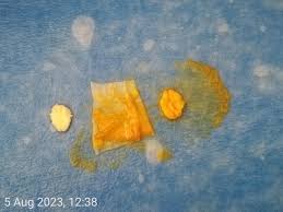 Attēlu rezultāti vaicājumam “Badhamia sp.”