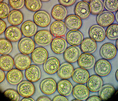 Attēlu rezultāti vaicājumam “Lycogala ustulatum”