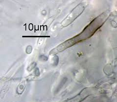 Attēlu rezultāti vaicājumam “Hymenoscyphus sp.”