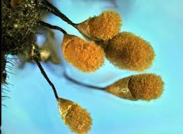 Attēlu rezultāti vaicājumam “Hemitrichia calyculata young”