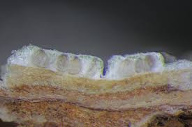 Attēlu rezultāti vaicājumam “Pertusaria pertusa”