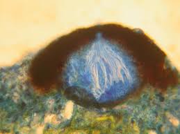 Attēlu rezultāti vaicājumam “Arthonia byssacea”