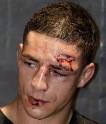 MMA: Diego Sanchez and the 30 Most Gruesome Post-Fight Photos on ... - DiegoSanchez2_display_image