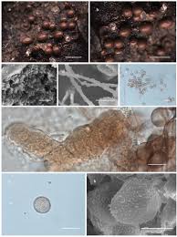 Attēlu rezultāti vaicājumam “Physarum bryomacrocarpum spores”