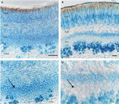 Attēlu rezultāti vaicājumam “Hypotrachyna sp.”