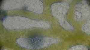 Attēlu rezultāti vaicājumam “Craterium minutum spores”