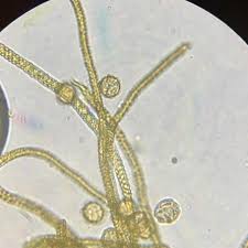 Attēlu rezultāti vaicājumam “Oligonema persimile”