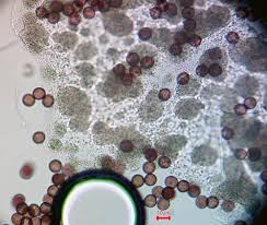 Attēlu rezultāti vaicājumam “Lycogala ustulatum macro”