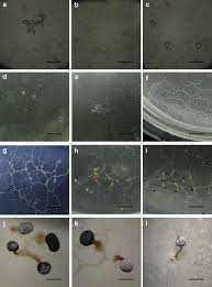 Attēlu rezultāti vaicājumam “Physarum globuliferum spores”