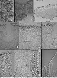 Attēlu rezultāti vaicājumam “Hypocrea rufa”