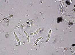 Attēlu rezultāti vaicājumam “Opegrapha rufescens”