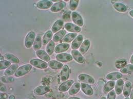 Attēlu rezultāti vaicājumam “Neocudoniella albiceps”