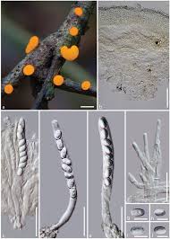 Attēlu rezultāti vaicājumam “Stemonitopsis aequalis (var. aequalis) spores”