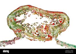 Attēlu rezultāti vaicājumam “Eriophyes laevis”