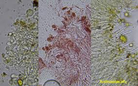 Attēlu rezultāti vaicājumam “Sidera lenis”