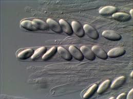 Attēlu rezultāti vaicājumam “Cheilymenia stercorea”