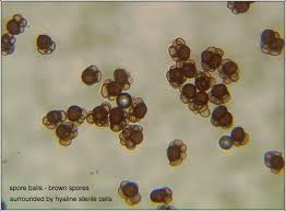 Attēlu rezultāti vaicājumam “Urocystis anemones”