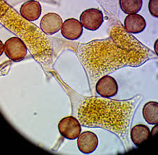 Attēlu rezultāti vaicājumam “Lycogala cf. oleocrystalliferum”