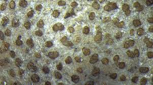 Attēlu rezultāti vaicājumam “Lycogala leopardinum macro”