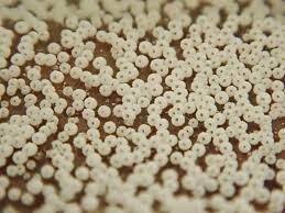 Attēlu rezultāti vaicājumam “Henningsomyces candidus”