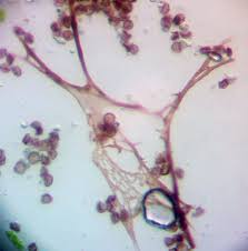 Attēlu rezultāti vaicājumam “Didymium annulisporum spores”