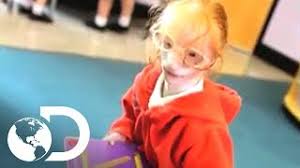 Image result for Nanismo Primordial