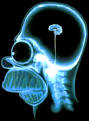 <b>DEMENZA</b> PRECOCE